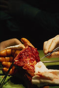 686089 Orthopedic Surgery, Suturing A Hand Wound After Pub Fight A4 Photo Print