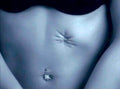 Abdominal Scar Belly Vintage Retro Advert Poster A4 Photo Print