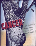 Cancer Growth Veins 1 Vintage Retro Advert Poster A4 Photo Print