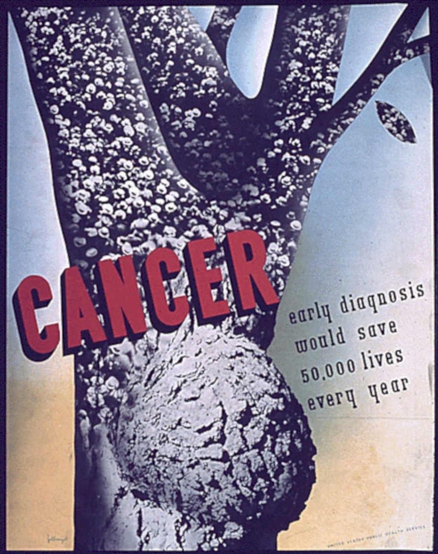 Cancer Growth Veins 1 Vintage Retro Advert Poster A4 Photo Print