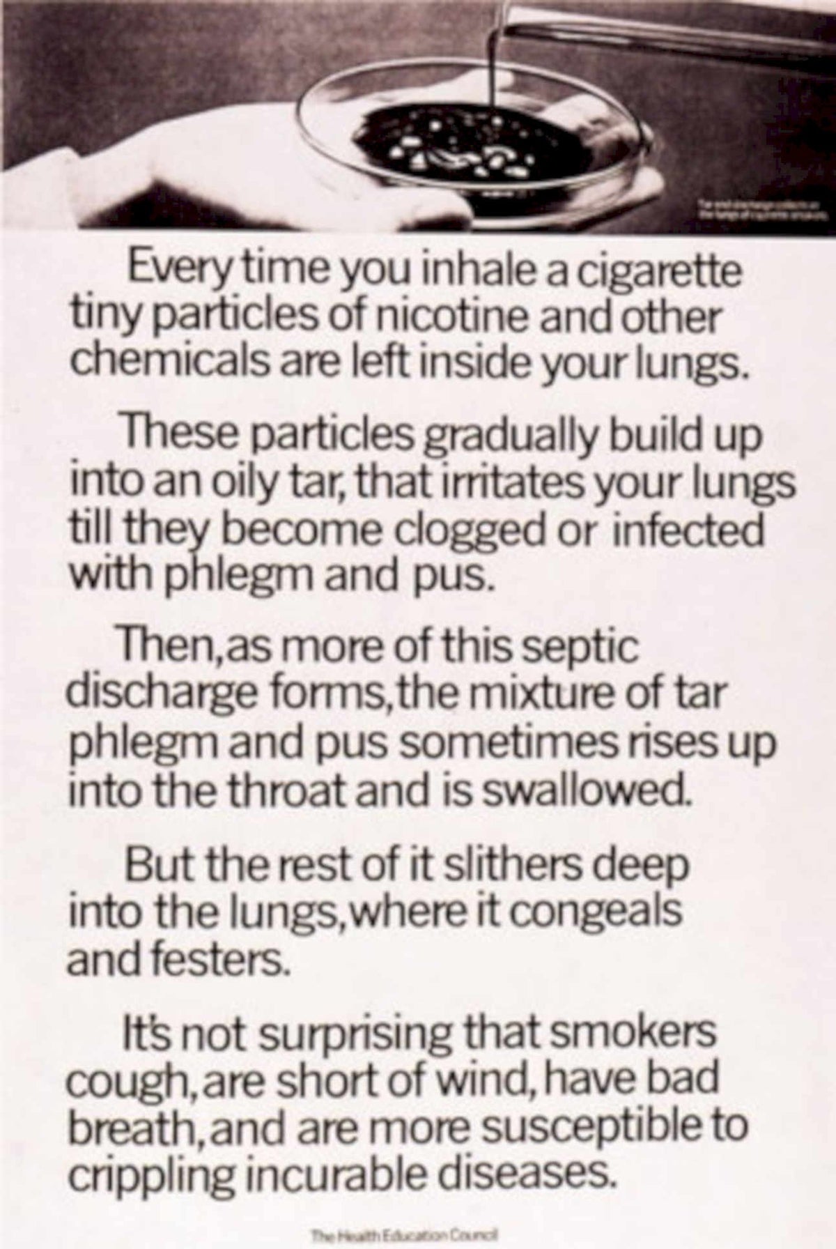 Cigarette Lungs Warning 1970s Vintage Retro Advert