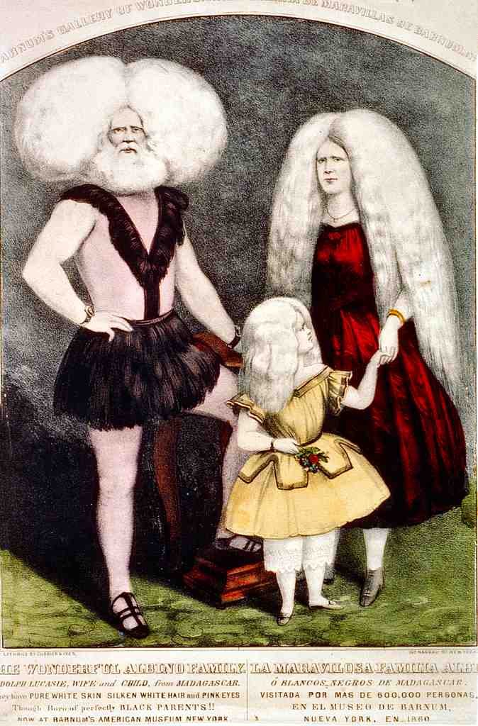 Circus The Wonderful Albino Family Vintage A4 Photo Print