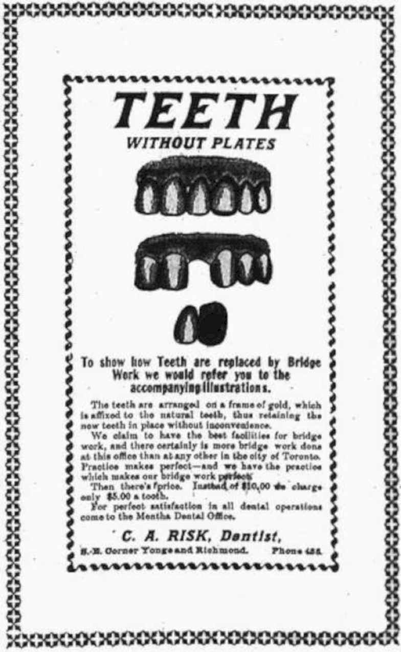 Gold Teeth Risk Vintage Retro Advert Ads A4 Photo Print