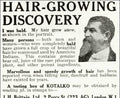 Kotalko Hair Growth Vintage Retro Advert Poster A4 Photo Print