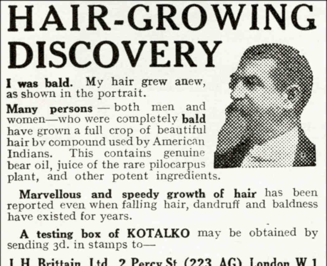 Kotalko Hair Growth Vintage Retro Advert Poster A4 Photo Print