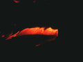 Landscape Anterior Mitral Valve A4 Photo Print
