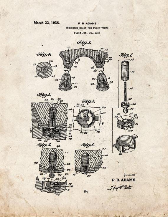 Patent Blueprint 5617 1 12 A4 Photo Print