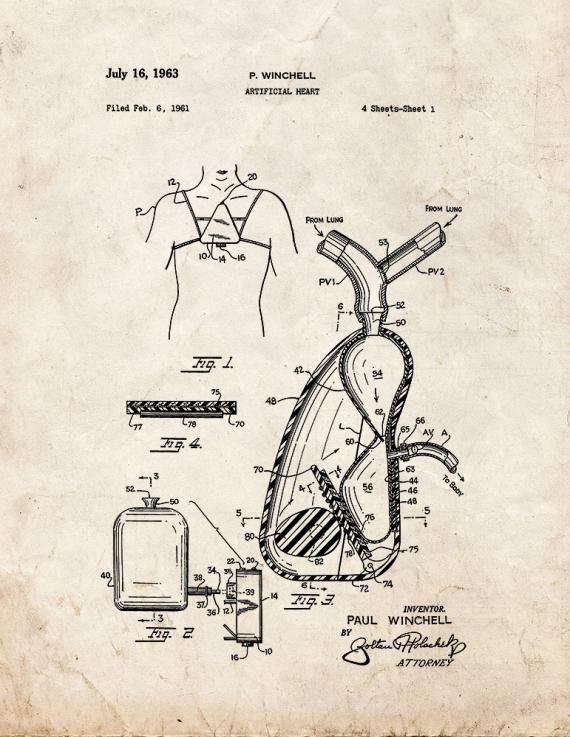 Patent Blueprint 5852 1 12 A4 Photo Print