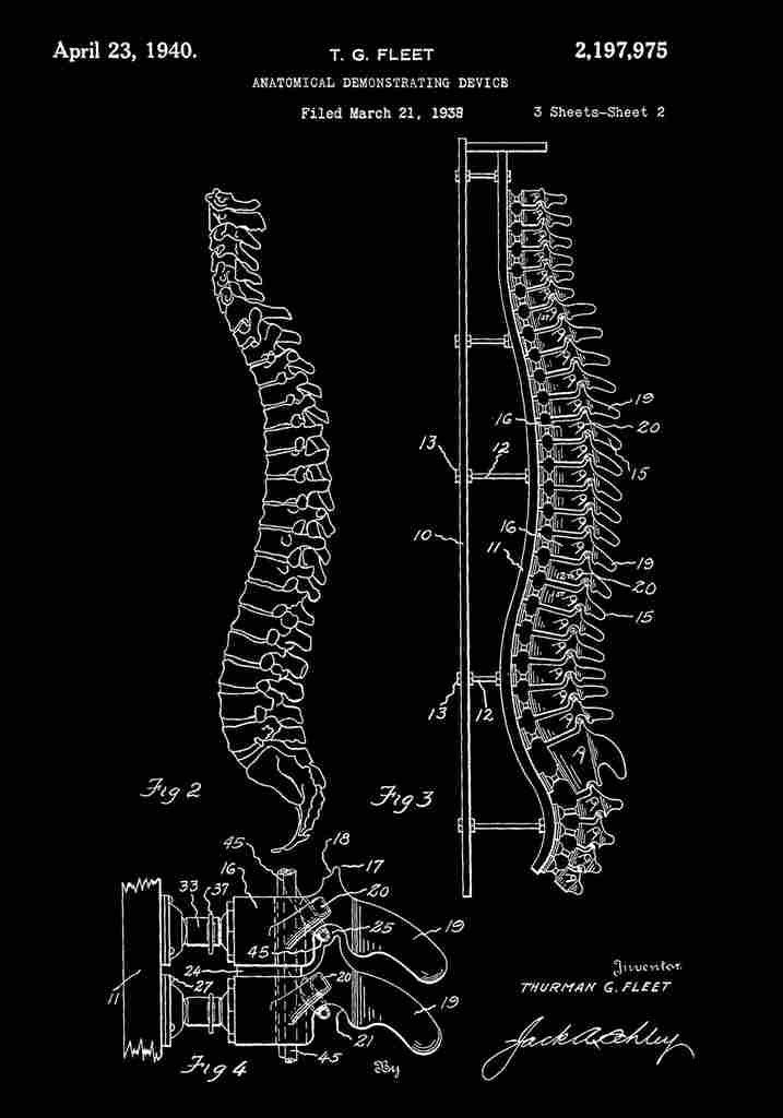 Patent Blueprint Spine black A4 Photo Print