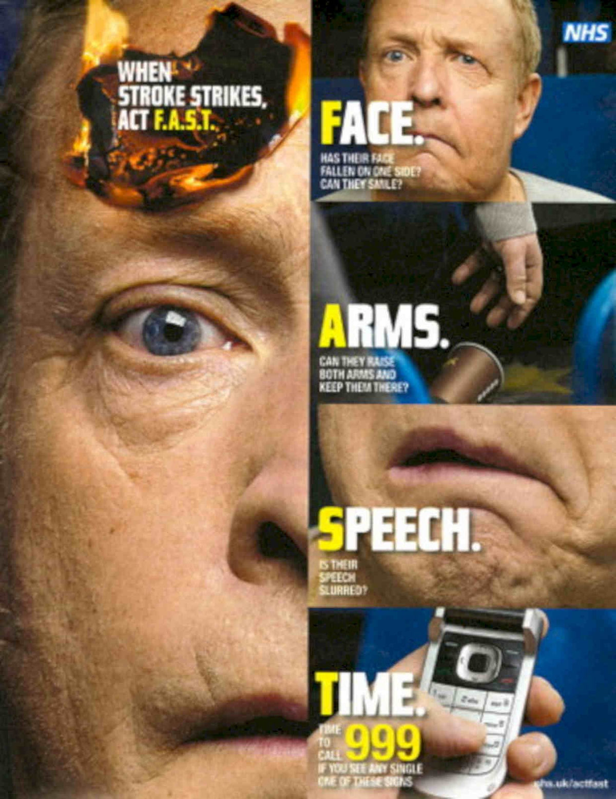 Stroke Fast Time Vintage Retro Advert Poster A4 Photo Print