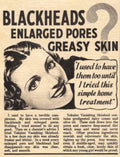Tokalon Skinfood Blackheads 1940s Vintage Retro Advert Poster