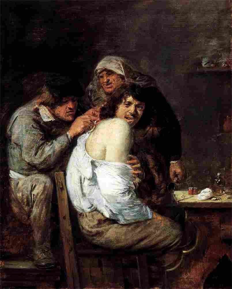 brouwer the back operation Art A4 Photo Print