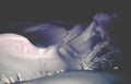 c4 c5 fracture Vintage A4 Photo Print