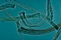 ceratocystis elegans hyphae1980s 1990s A4 Photo Print