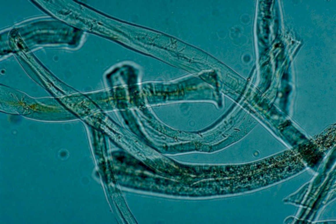 ceratocystis elegans hyphae1980s 1990s A4 Photo Print