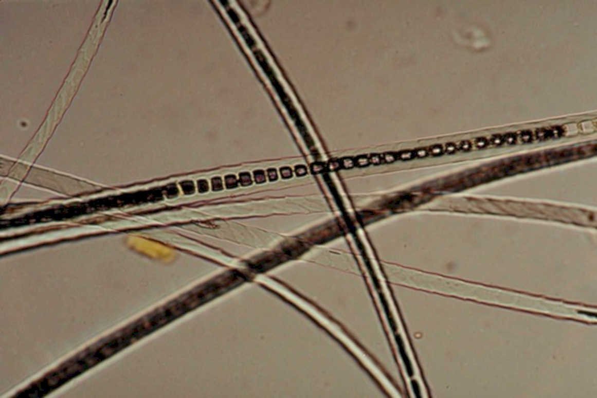 ceratocystis hyphae beaded1980s 1990s A4 Photo Print