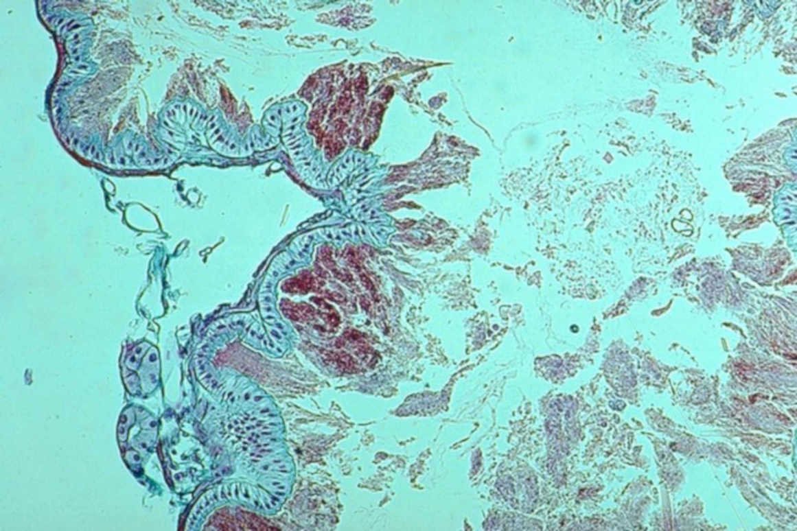 colon he tissue1980s 1990s A4 Photo Print