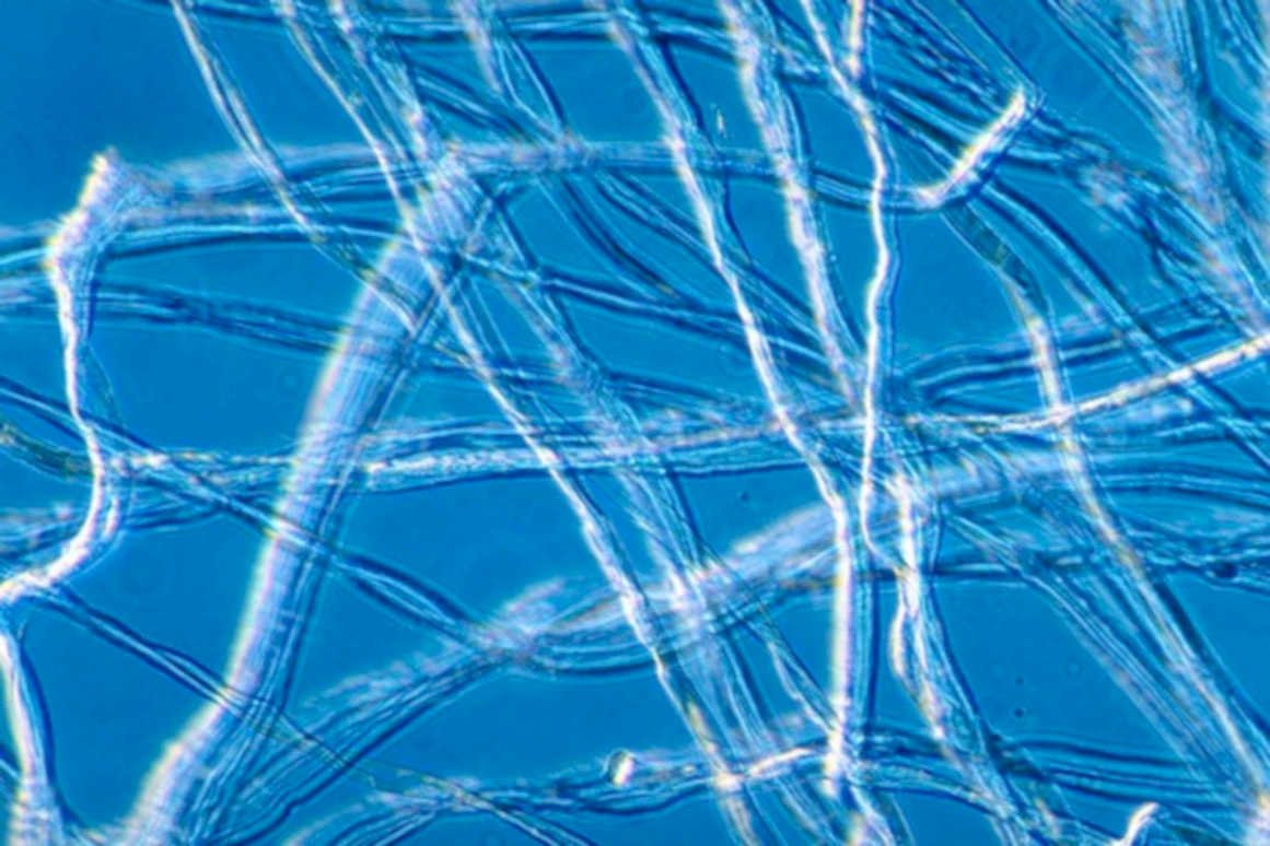 fungal hyphae network1980s 1990s A4 Photo Print