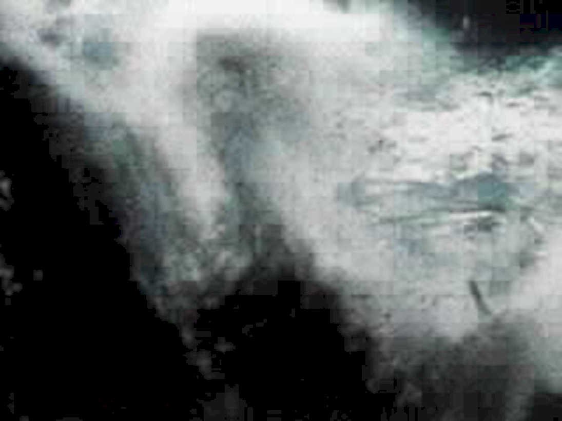 head xray frontal1980s 1990s A4 Photo Print