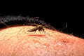 mosquito bite skin1980s 1990s A4 Photo Print