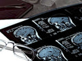 mri brain scan1980s 1990s A4 Photo Print