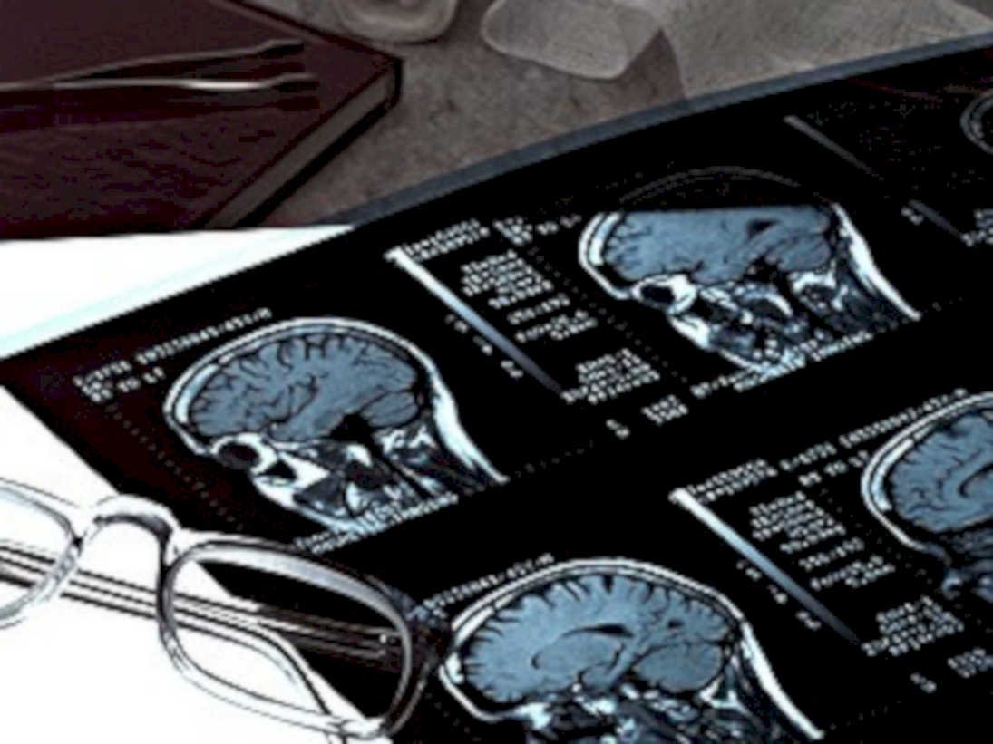 mri brain scan1980s 1990s A4 Photo Print