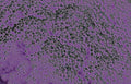 purple brain tissue