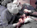 surgical operation torso1980s 1990s A4 Photo Print