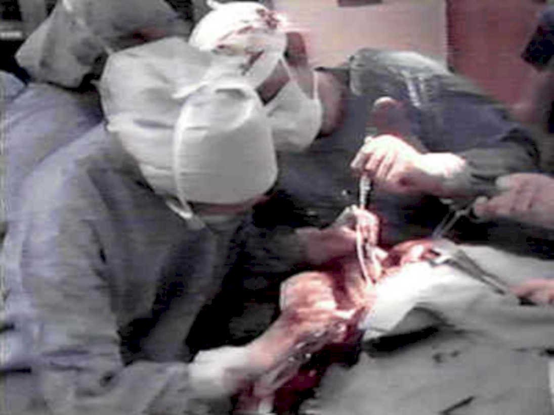 surgical operation torso1980s 1990s A4 Photo Print