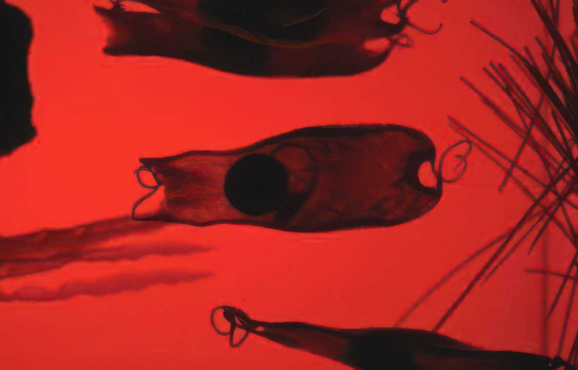 trypanosoma blood smear Vintage A4 Photo Print